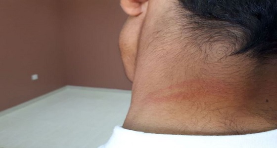 طالب يتعرض للاعتداء البدني بالضرب المبرح بخرطوم المياة 