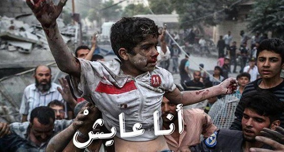 بالصور.. &#8221; انا عايش &#8221; تعبر عن وجع ودمار أطفال الغوطة الشرقية