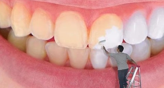 ” القرنفل ” و ” البصل ” للقضاء على إصفرار الأسنان