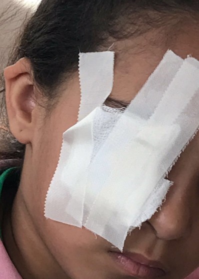 خلاف طالبات أول ابتدائي ينتهي بمقص في عين طالبة!