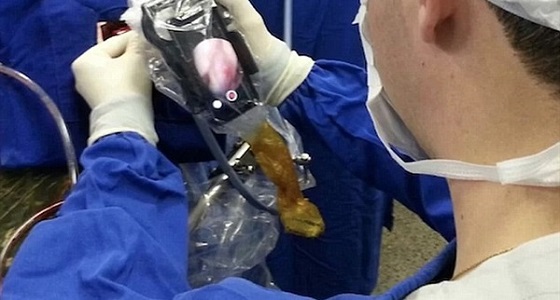 استخدام الجوال أداة لإجراء عمليات الجراحة