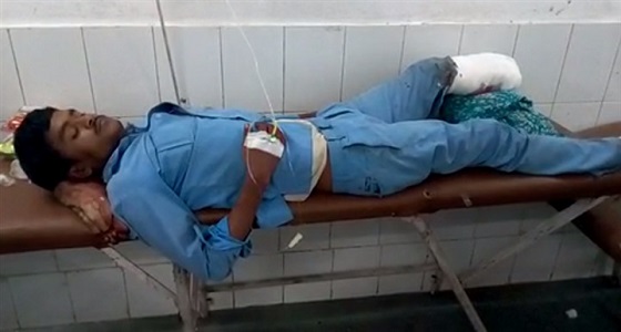 فيديو مروع لمصاب يستخدم قدمه المبتورة كوسادة في مستشفى