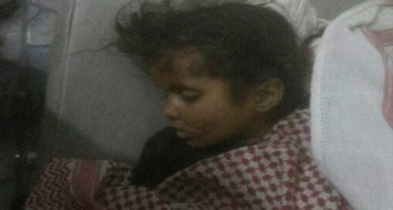 قناص حوثي يقتل طفلة يمنية شرق محافظة تعز جنوب البلاد