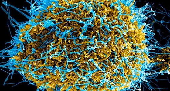 ملايين البشر حول العالم في خطر بعد اكتشاف مرض غامض