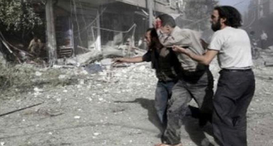 المرصد السوري: 30 حالة اختناق بعد قصف جوي على الغوطة الشرقية