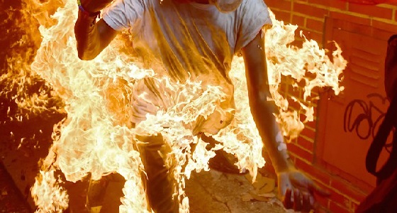 سيدة تشعل النيران في حبيبها انتقاما منه