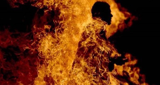 سيدة تشعل النيران في ابن زوجها لمحاولته معاشرتها جنسيا