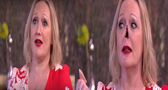 بالفيديو.. سيدة تزيل أنفها الصناعية على الهواء
