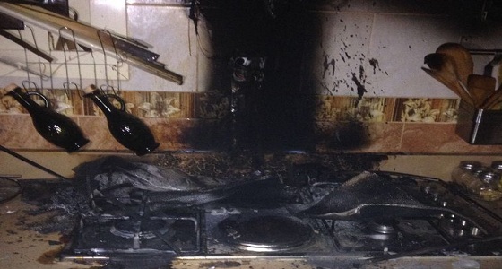 بالصور.. إصابة رجل وإمرأة بسبب حريق في الباحة