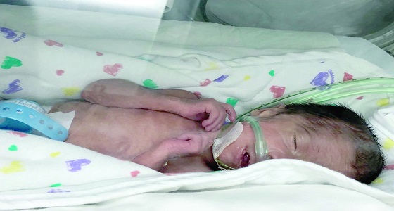 تفاصيل جديدة يرويها والد الـ 3 توائم المتوفيين في الدمام