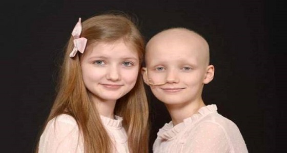 طفلة تصاب بالسرطان فتظهر أعراضه على توأهما المطابق