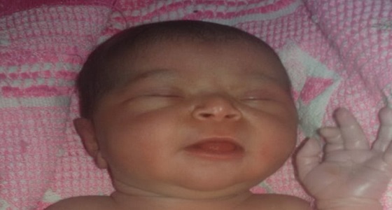 والد طفلة ولدت بأمعاء خارج جسدها يناشد وزارة الصحة بالتكفل بعلاجها