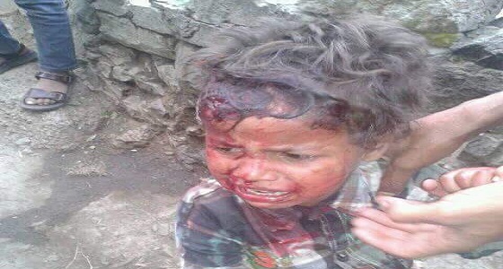 الحوثيون يبحثون عن انتصار باغتيال الأطفال والمدنيين باليمن