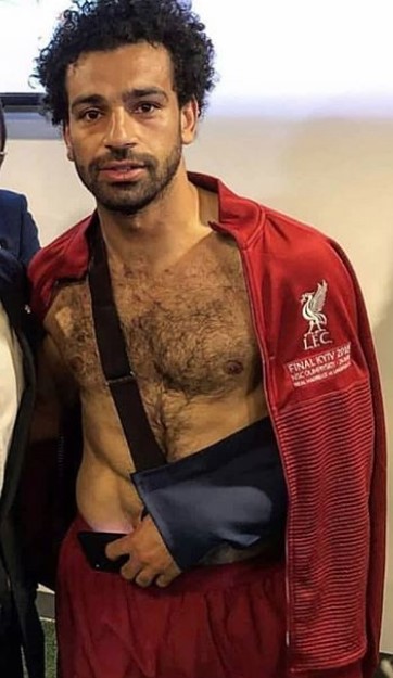 محمد صلاح بعد الاصابة