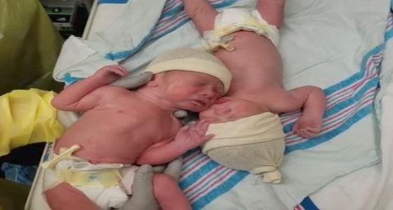 فيديو مؤثر لتوأم يهدئان بعضهما بعد الولادة