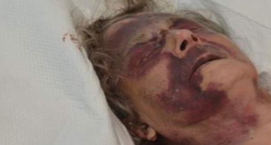 اعتداء مروع للبلطجية على إمرأة تسعينية أثناء نومها