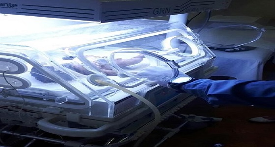 بالصور.. إنقاذ رضيعة بعد دفنها حية لمدة ثمان ساعات