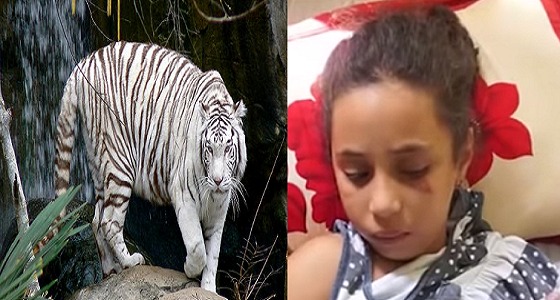 بالفيديو.. بتر يد طفلة بسبب عضة نمر