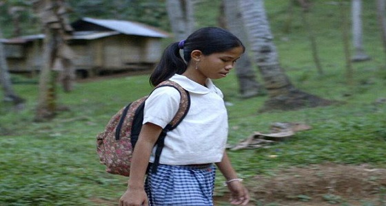 بالصور.. في حالة نادرة.. طفلة تولد بجنين يتدلى من بطنها