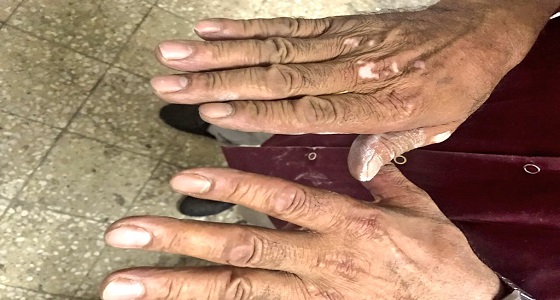 بالصور.. إغلاق مخبزين مخالفين في نجران