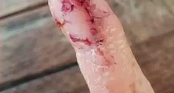 سمكة قرش تجذب امرأة حاولت إطعامها