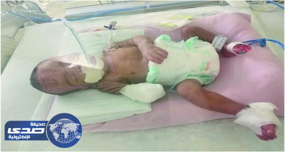 تقرير صحة جازان يعترف: بتر يد ” رضيع أبوعريش ” خالف مزاولة المهنة