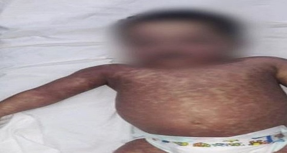 وفاة طفل بمستشفى الولادة والأطفال بمكة.. و ” الوالد ” يطالب الصحة بالتحقيق