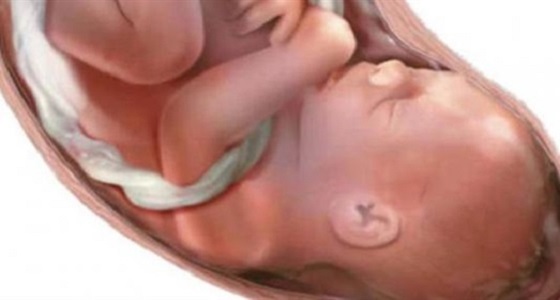 العيوب الخلقية في الجنين وطرق اكتشافها وعلاجها