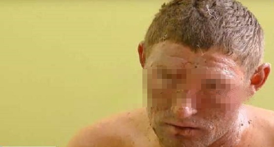 اعترافات مثيرة لرجل حرق خطيبته: ” حرقتها لإشعالها نيران الغيرة بقلبي “