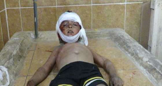 وفاة طفل يمني قنصًا في الرأس برصاص الحوثيين