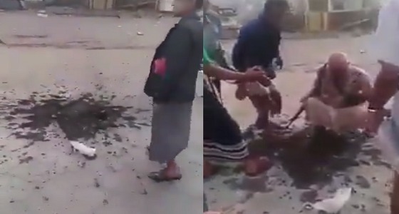 فيديو يفضح قصف الحوثيين لمستشفى الثورة