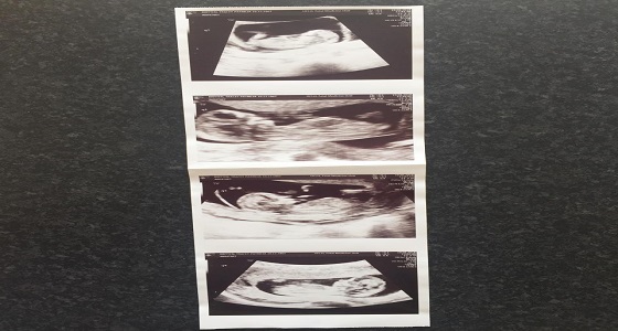 بالصور.. جدة تصبح ” أم ” في الخمسين من عمرها