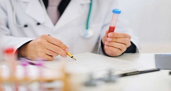 باحثون يطورون طريقة لمعرفة موعد وفاتك بتحليل الدم