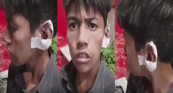 بالفيديو.. منسوبي بلدية طهران يقطعون أذن طفل لبحثه بالقمامة عن أشياء يبيعها