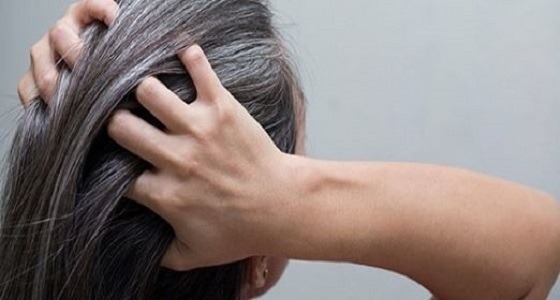 أسباب ” الشيب المبكر ” وكيفية التحكم فيه