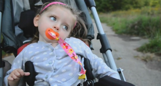 احذري.. الشد الخاطئ للطفل أثناء عملية الولادة يصيبه بالشلل