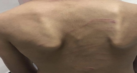 مواطنة تشكو من تعنيف طليقها لأحد أطفالها بجازان.. والحماية تتفاعل