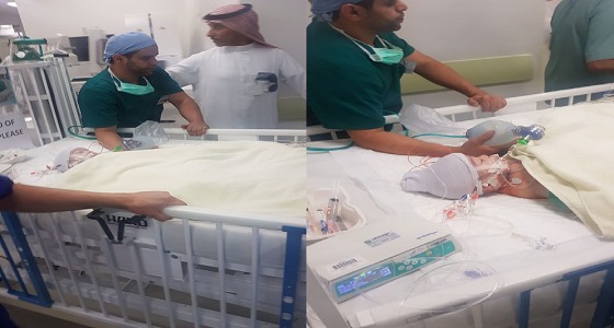 الدكتور الربيعة يكشف لـ ” صدى ” التحديات التي واجههوها في عملية فصل التوأم السيامي
