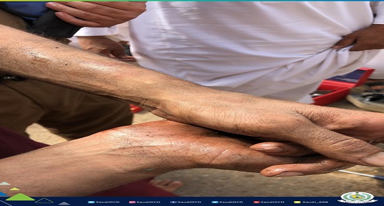 احتجاز يد مواطن داخل خزان وقود سيارة.. ومدني القريات يباشر