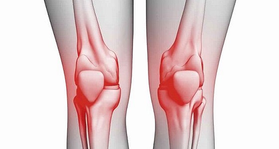 أعراض نقص الكالسيوم  والأمراض الناتجة عنه