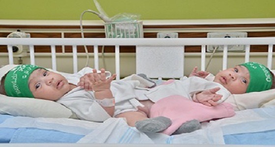 والد التوأم السيامي يكشف السبب وراء إجراء العملية بالمملكة وطريقة تعامل الأطباء