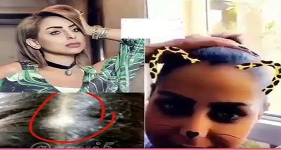 بالفيديو ..” هند البلوشي ” تفقد شعرها بسبب الضغط النفسي