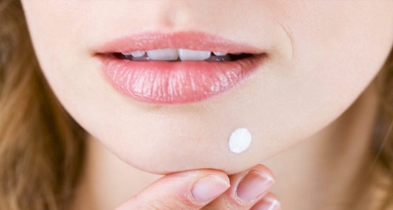 احذرى.. إهمال علاج حب الشباب يسبب تشوهات بالوجه