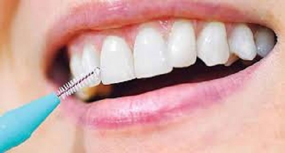 5 خطوات لمنع تكون الجير على الأسنان