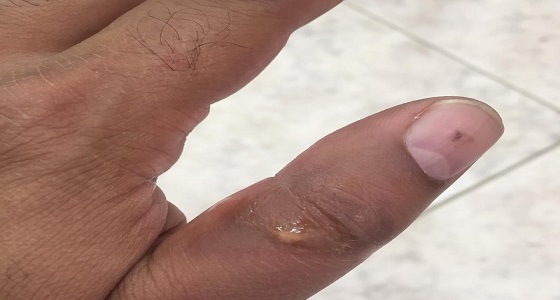 بالفيديو.. شجاعة مواطن تنقذ محتجزين داخل مركبة من حريق مروع