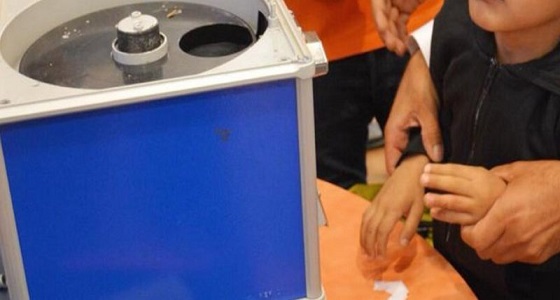 بالصور.. احتجاز يد طفل بـ ” اسكتشر ” في أحد المراكز التجارية