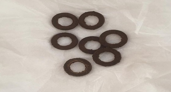 بالصور.. مواطن يعثر على 7 ربلات مطاطية داخل طبق الفول بجازان