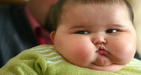 السمنة عند الأطفال: الأسباب وطرق العلاج