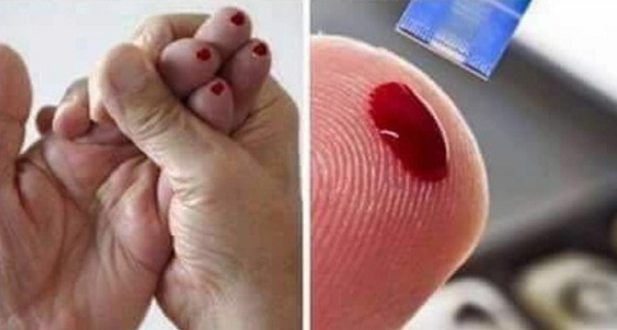 تعرّف على صحة معلومة ” وخز الأصابع مع شحنة الأذن يشفي من الجلطة “