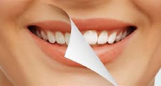 طريقة بسيطة لأسنان ناصعة البياض